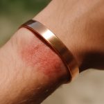 découvrez les risques potentiels du bracelet en cuivre pour votre peau et comment les éviter afin de profiter pleinement de ses bienfaits en toute sécurité.